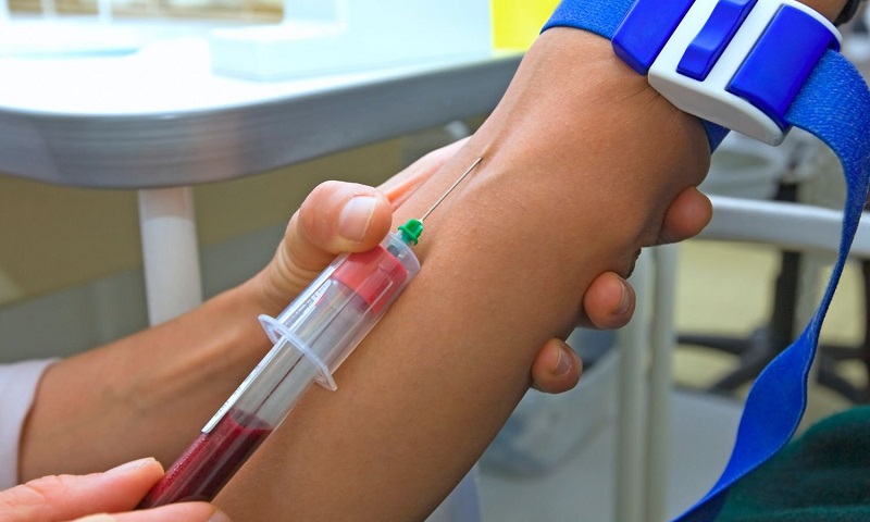 Сдача анализа крови ПСА при простатите