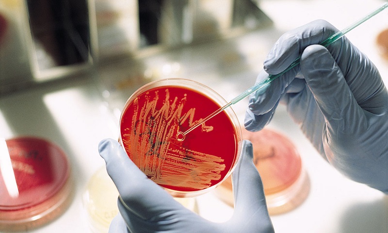 Проникновение бактерий в уретру